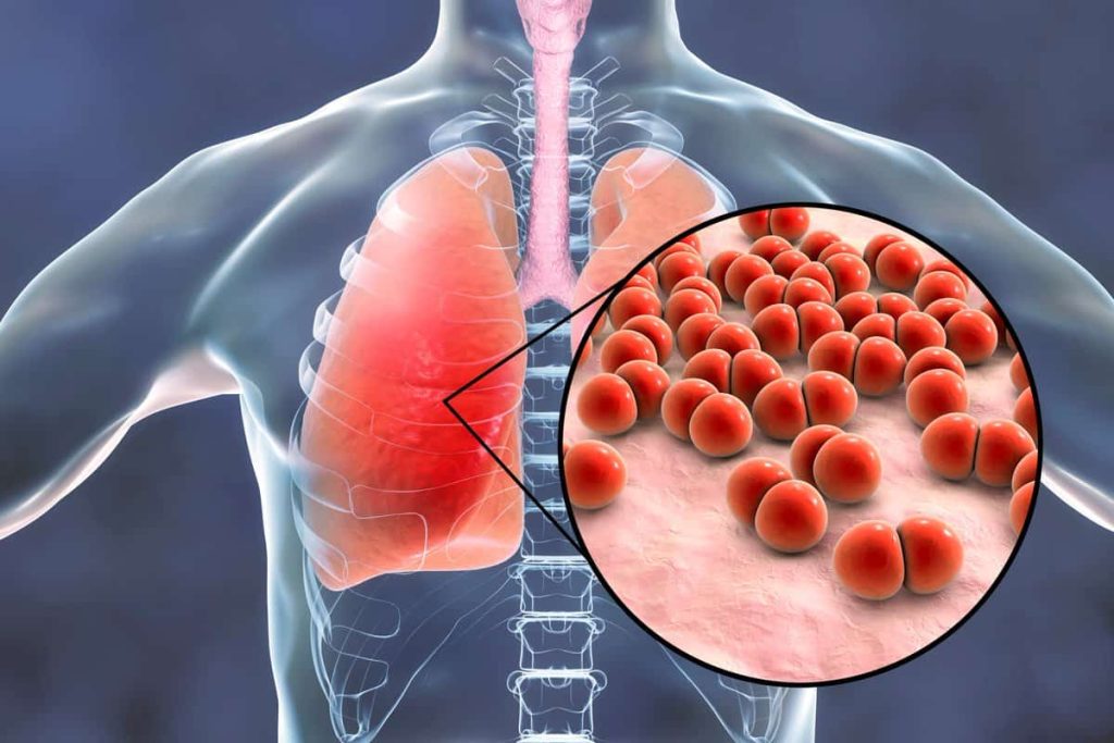 Concerning rise in tuberculosis cases in Tangier surpassing 2500 infections